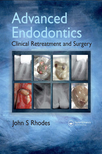 Advanced Endodontics: Clinical Retreatment and Surgery