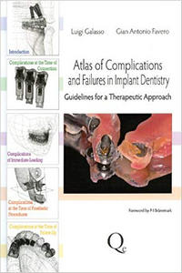 Atlas of Complications and Failures in Implant Dentistry: Guidelines for a Therapeutic Approach