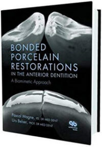 Bonded Porcelain Restorations in the Anterior Dentition: A Biomimetic Approach