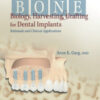 Bone Biology Harvesting Grafting For Dental Implants