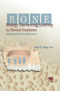 Bone Biology Harvesting Grafting For Dental Implants