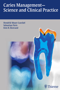 Caries Management: Science and Clinical Practice