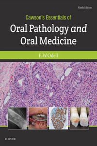 Cawson’s Essentials of Oral Pathology and Oral Medicine, 9th Edition