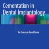 Cementation in Dental Implantology: An Evidence-Based Guide