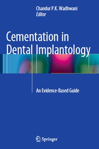 Cementation in Dental Implantology: An Evidence-Based Guide