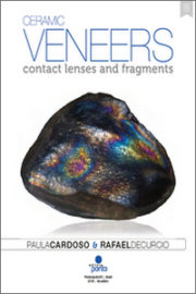 Ceramic Veneers: Contact Lenses and Fragments