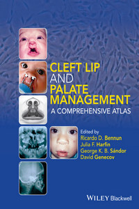 Cleft Lip and Palate Management: A Comprehensive Atlas