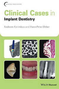 Clinical Cases in Implant Dentistry