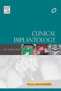 Clinical Implantology, 1st Edition
