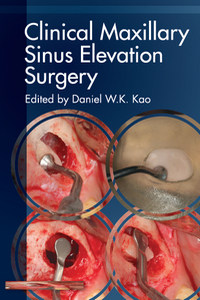 Clinical Maxillary Sinus Elevation Surgery