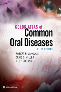 Color Atlas of Common Oral Diseases, 5th edition
