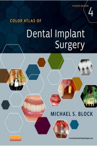 Color Atlas of Dental Implant Surgery, 4th Edition