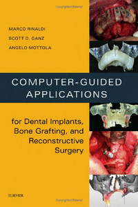 Computer-Guided Applications for Dental Implants, Bone Grafting, and Reconstructive Surgery