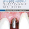 Contemporary Restoration of Endodontically Treated Teeth