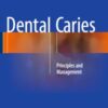 Dental Caries: Principles and Management