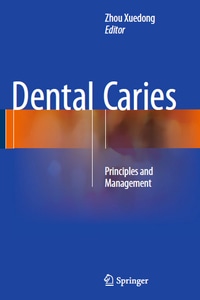 Dental Caries: Principles and Management