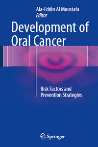 Development of Oral Cancer: Risk Factors and Prevention Strategies