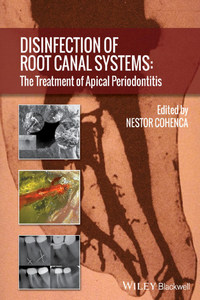 Disinfection of Root Canal Systems: The Treatment of Apical Periodontitis