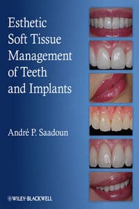 Esthetic Soft Tissue Management of Teeth and Implants