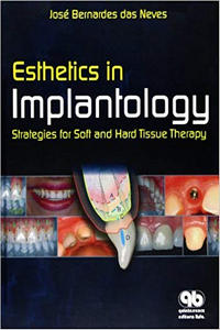 Esthetics in Implantology: Strategies for Soft and Hard Tissue Therapy