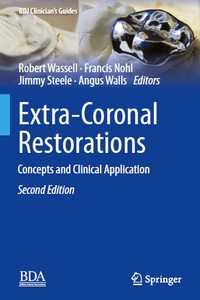 Extra-Coronal Restorations: Concepts and Clinical Application, 2nd Edition