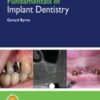 Fundamentals of Implant Dentistry