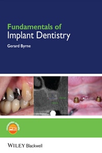 Fundamentals of Implant Dentistry