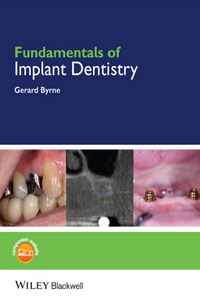 Fundamentals of Implant Dentistry