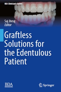 Graftless Solutions for the Edentulous Patient