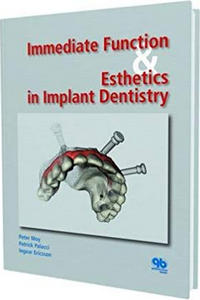 Immediate Function and Esthetics in Implant Dentistry