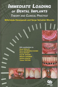 Immediate Loading of Dental Implants: Theory and Clinical Practice