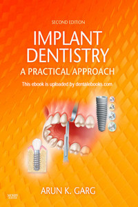 Implant Dentistry: A Practical Approach, 2nd Edition