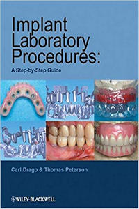 Implant Laboratory Procedures: A Step-by-Step Guide