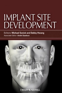 Implant Site Development