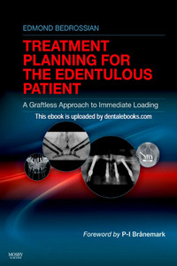 Implant Treatment Planning for the Edentulous Patient: A Graftless Approach to Immediate Loading