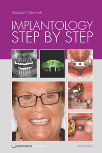Implantology Step by Step, 2nd Edition