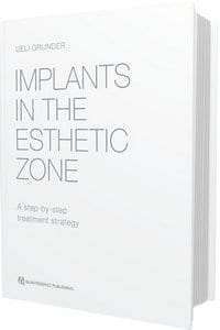 Implants in the Esthetic Zone: A Step-by-Step Treatment Strategy
