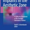 Implants in the Aesthetic Zone: A Guide for Treatment of the Partially Edentulous Patient
