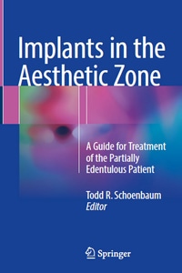 Implants in the Aesthetic Zone: A Guide for Treatment of the Partially Edentulous Patient