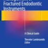 Management of Fractured Endodontic Instruments: A Clinical Guide