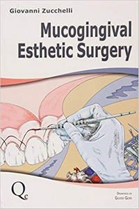 Mucogingival Esthetic Surgery, Zucchelli