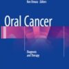 Oral Cancer