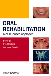 Oral Rehabilitation: A Case-Based Approach
