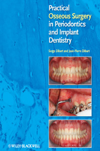 Practical Osseous Surgery in Periodontics and Implant Dentistry