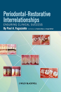 Periodontal-Restorative Interrelationships: Ensuring Clinical Success