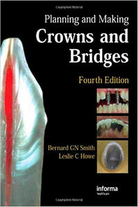 Planning and Making Crowns and Bridges, 4th Edition