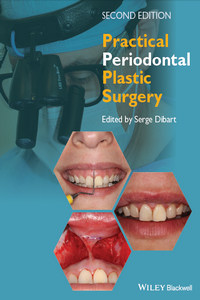 Practical Periodontal Plastic Surgery, 2nd Edition