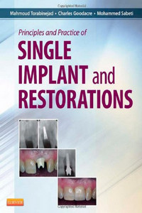 Principles and Practice of Single Implant and Restorations