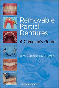 Removable Partial Dentures: A Clinician’s Guide