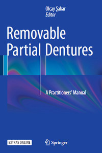 Removable Partial Dentures: A Practitioners’ Manual